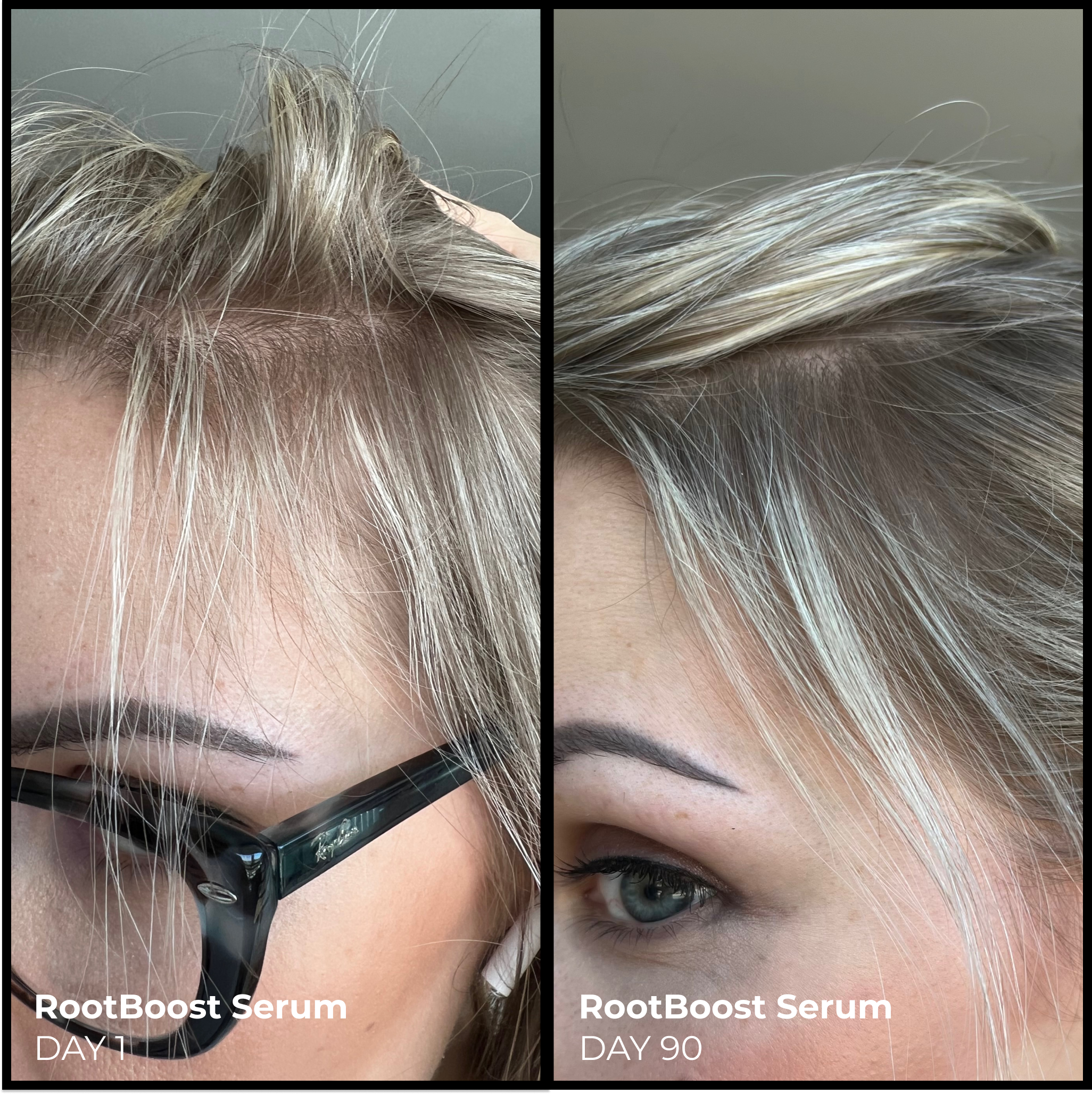 EVOLVh  Better Roots RootBoost Serum