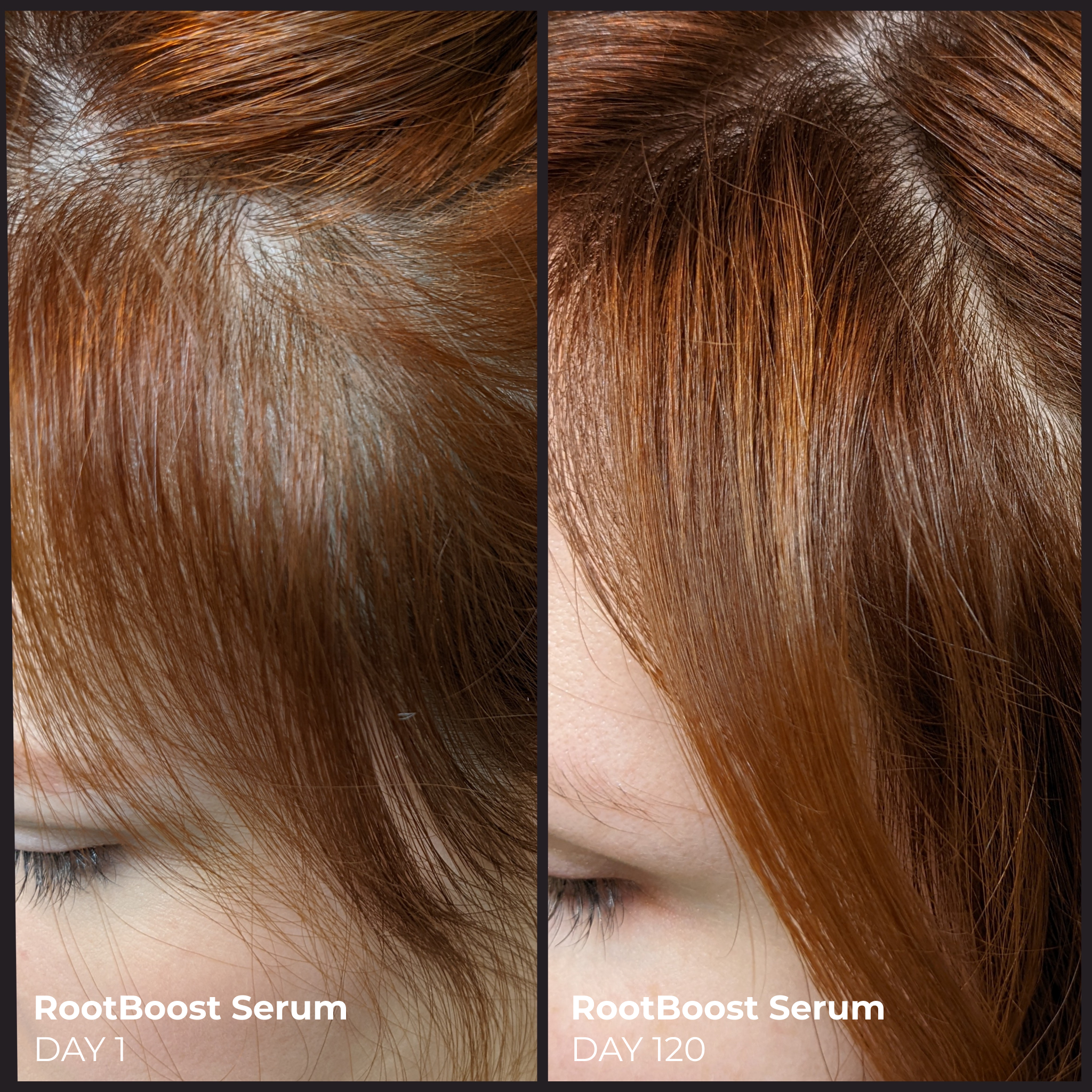 EVOLVh  Better Roots RootBoost Serum